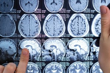 Σπουδαία ανακάλυψη: Επιστήμονες βρήκαν πώς πεθαίνουν τα εγκεφαλικά κύτταρα στη νόσο Αλτσχάιμερ - Τι προκαλεί κυτταρική αυτοκτονία