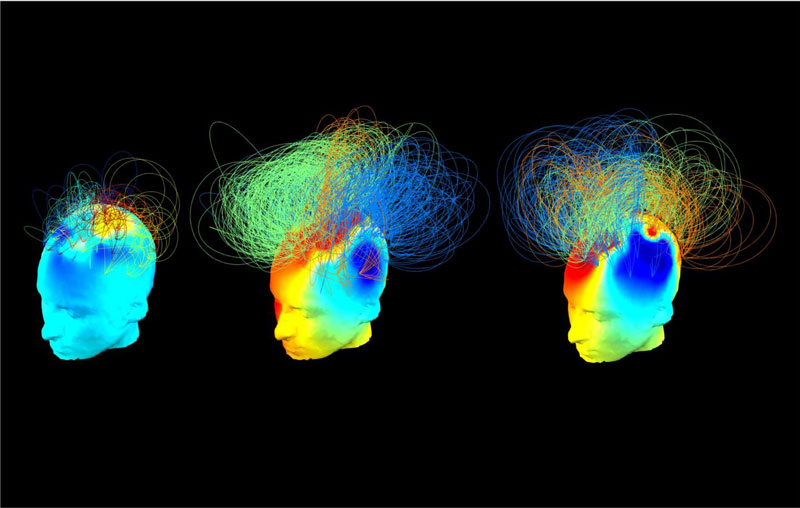 απεικονίσεις εγκεφάλου με χρώματα