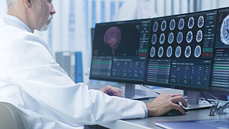γιατρός κοιτάει εγκεφαλικές απεικονίσεις στον υπολογιστή