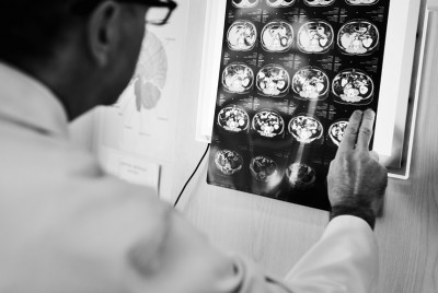 γιατρός εξετάζει ακτινογραφίες εγκεφάλου