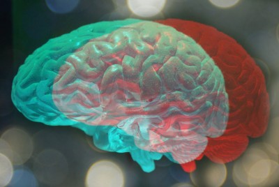 τρισδιάστατη απεικόνιση εγκεφάλου με άνοια στην Ευρώπη 